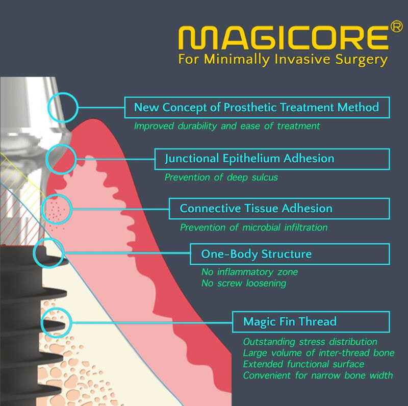 IBS MagiCore implant system diagram — Magic Fin Thread, One-Body Structure, Connective Tissue Adhesion, Junctional Epithelium Adhesion, and New Concept of Prosthetic Treatment